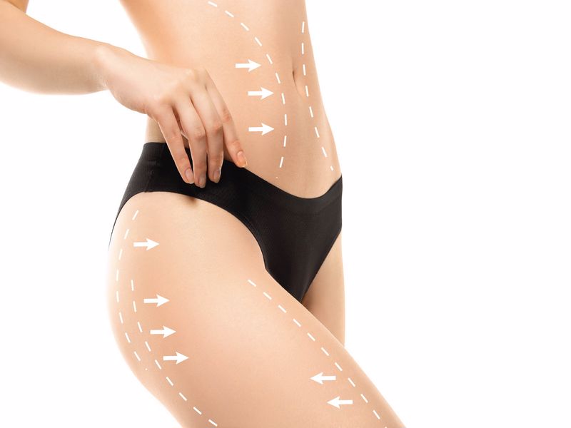 Laser Liposuction Plastik Rekonstr Ktif Ve Estetik Cerrahi